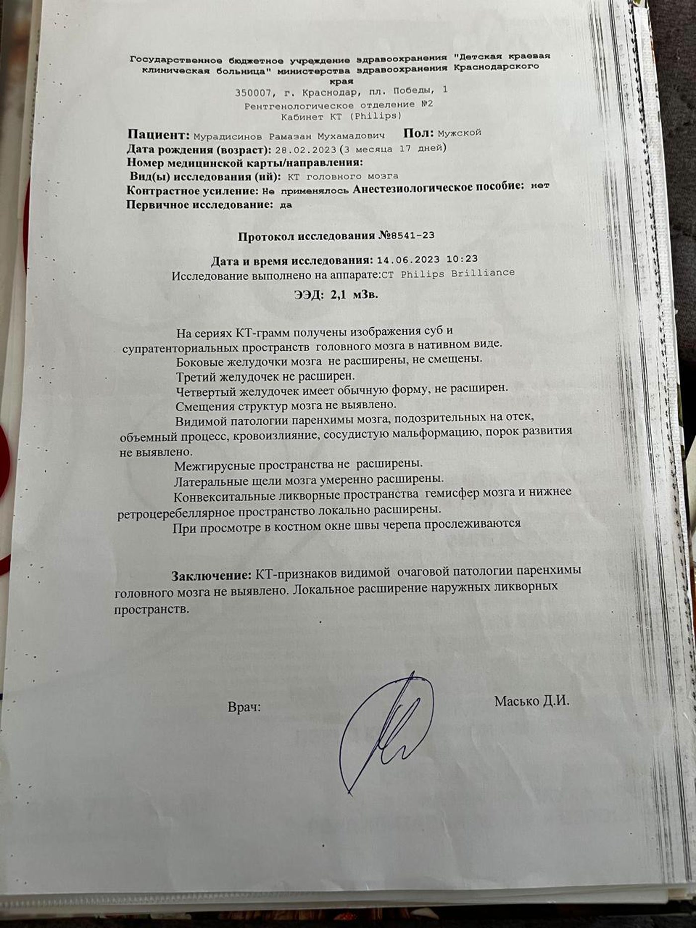 Скан протокола КТ головного мозга от 14 июня 2023 года: очаговой патологии не выявлено